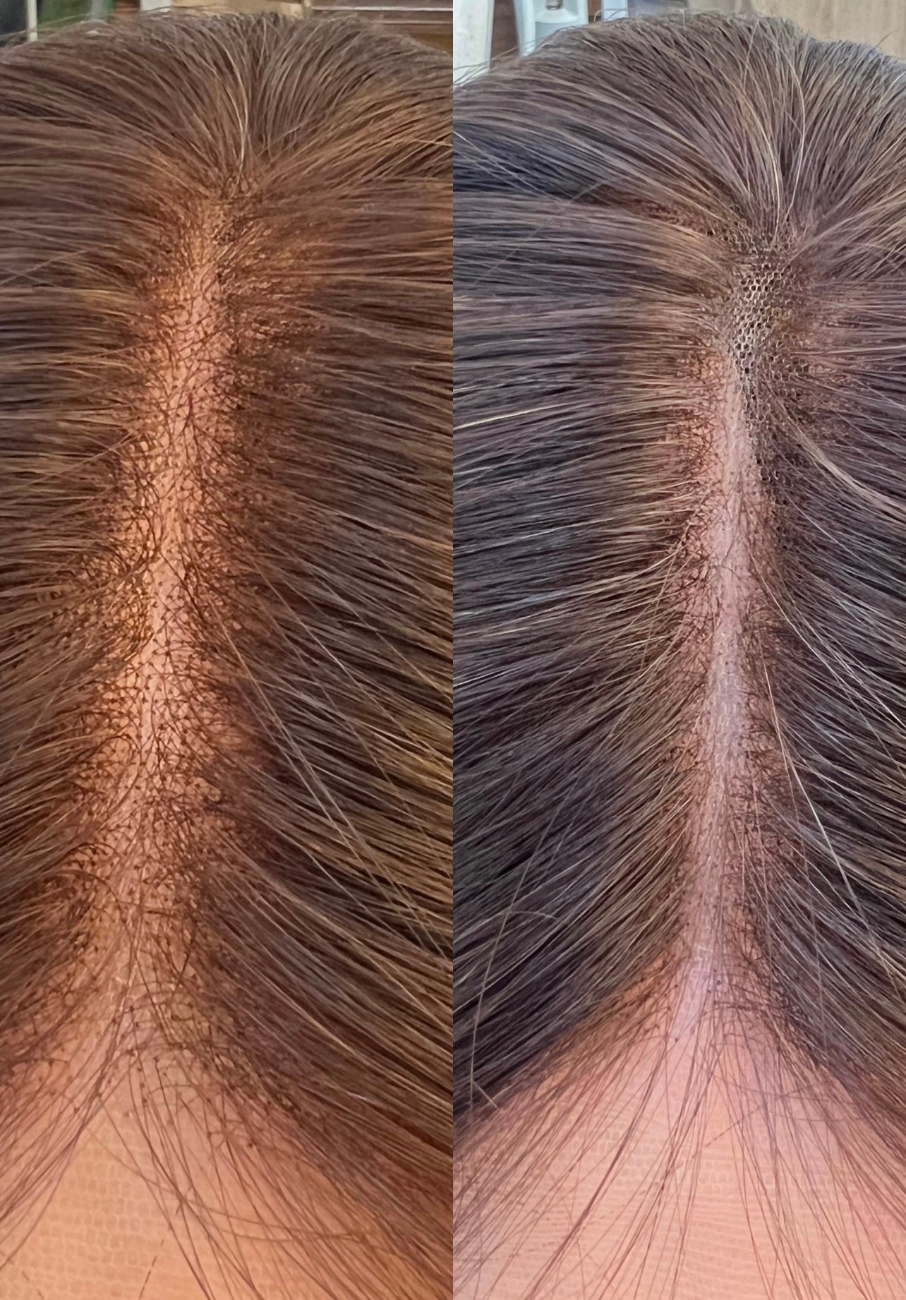 Knot Blur Pen (Limited Edition)